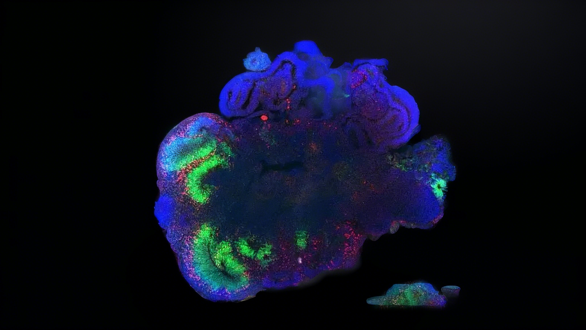 Organoid model construction.