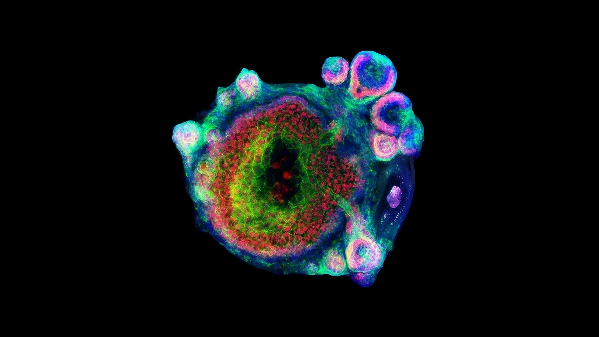 Drug-resistant organoid models.